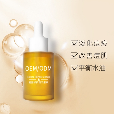 崇左市_祛痘精华原液OEM